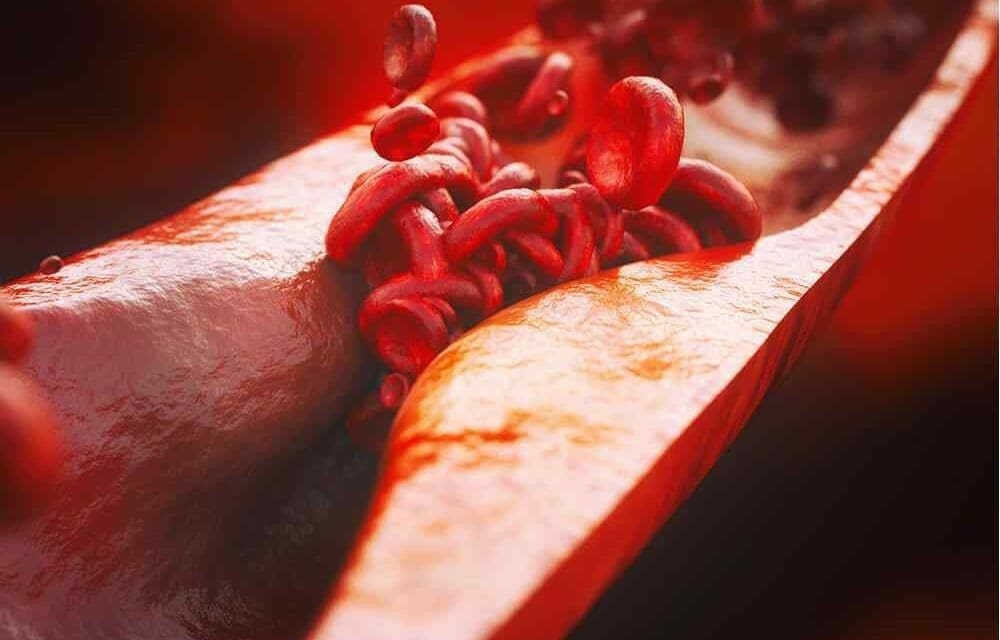 Cholesterol, what is it?